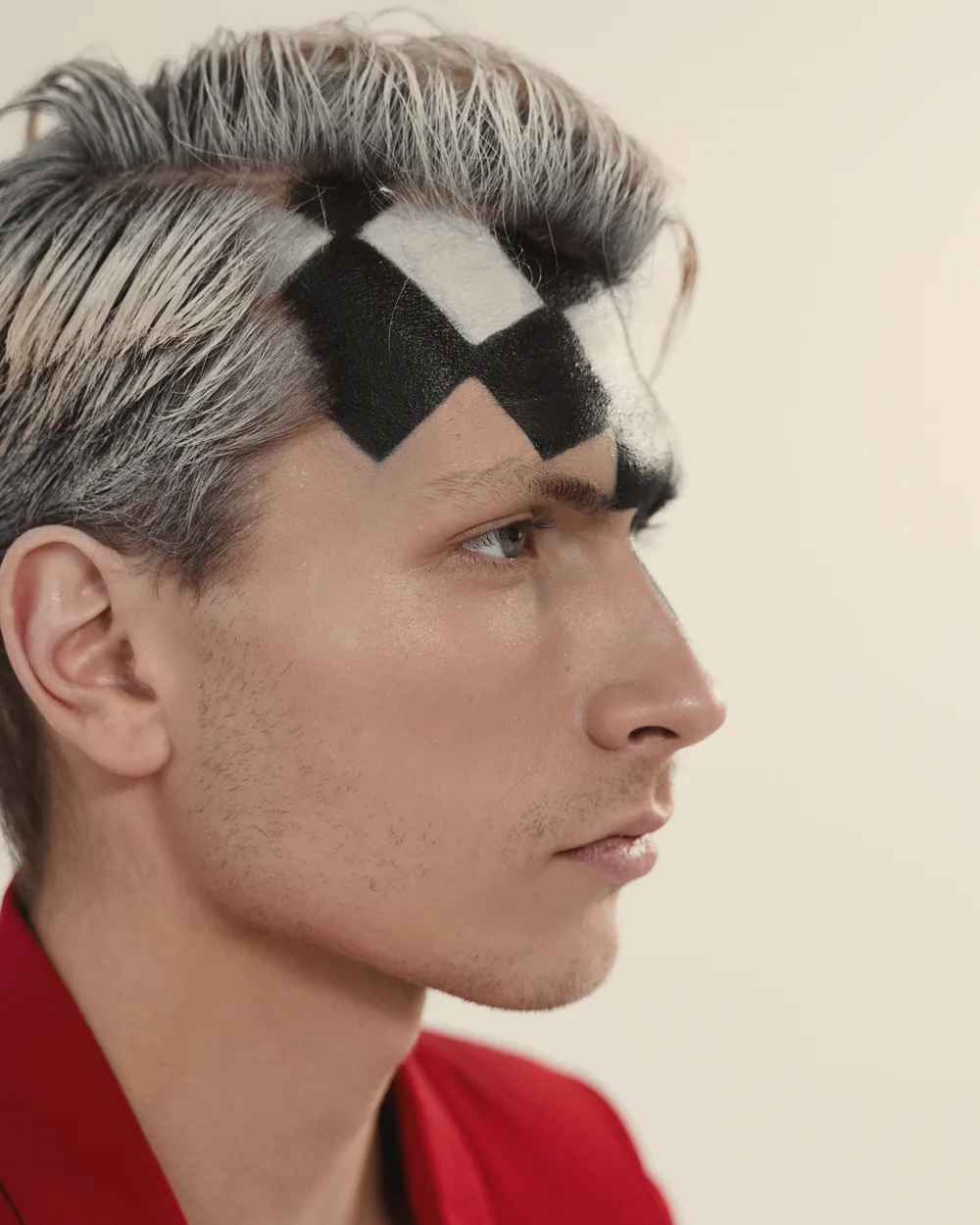 Diseño de la línea frontal marcado sobre la cabeza del paciente
